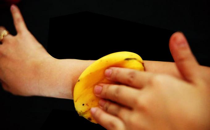 Banana kůže dokonale zmírňuje svědění od bodnutí komárem